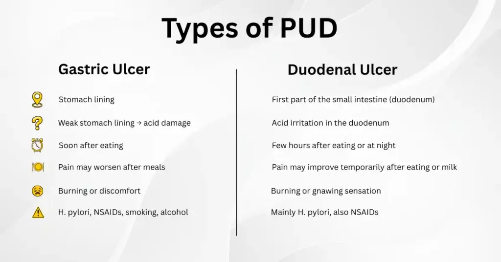 Comparison chart of Gastric and Duodenal ulcers by location, timing of pain, effect of food, and common causes