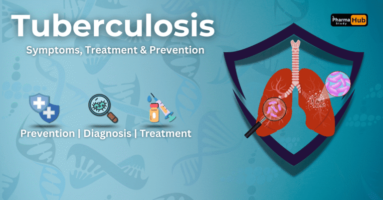 Tuberculosis